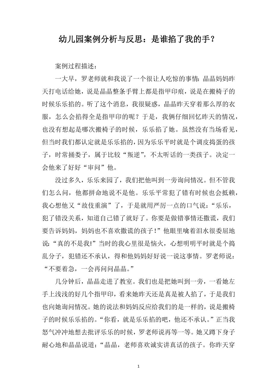 幼儿园案例分析与反思：是谁掐了我的手？_第1页
