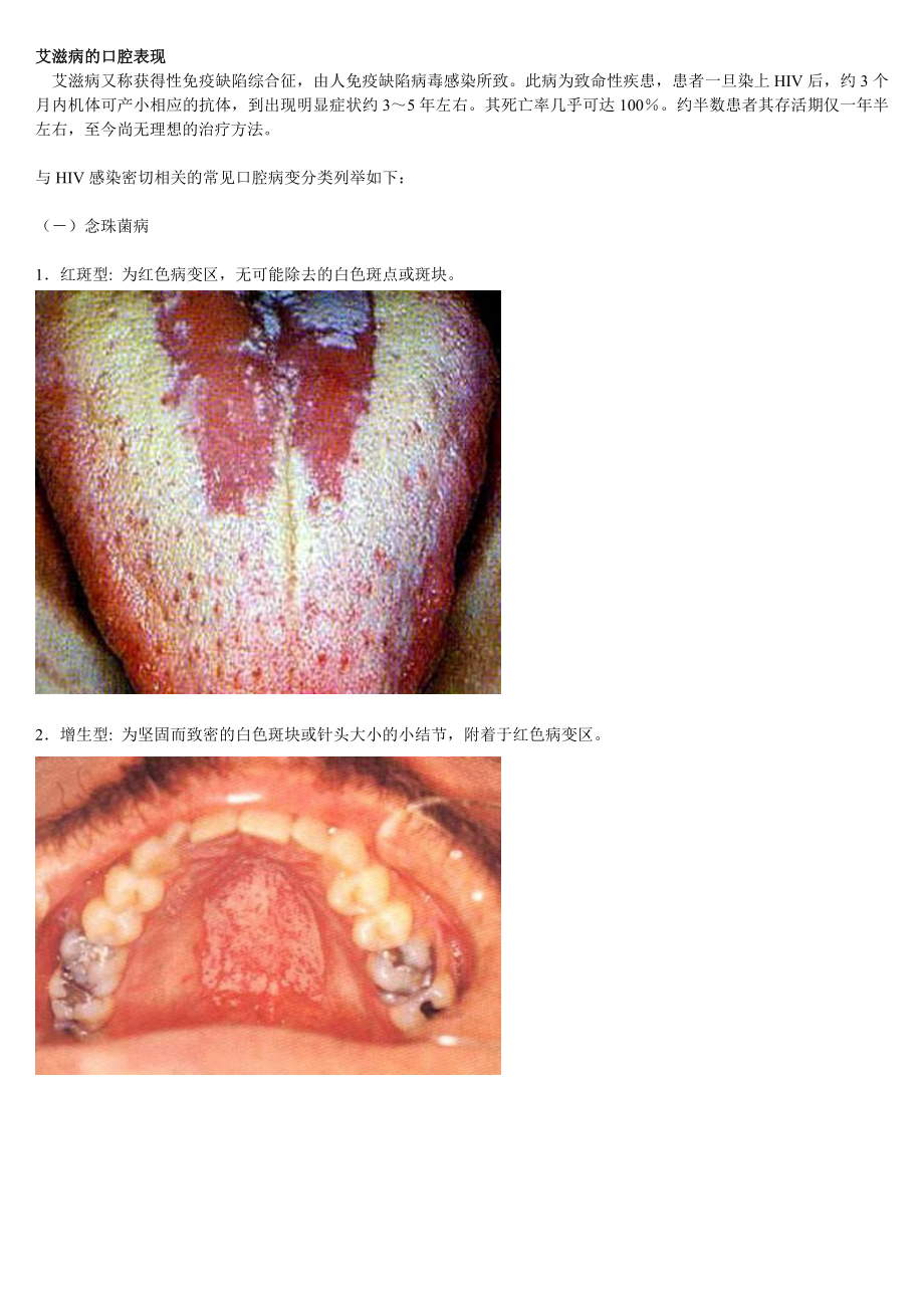 艾滋病的口腔表现图谱_第1页