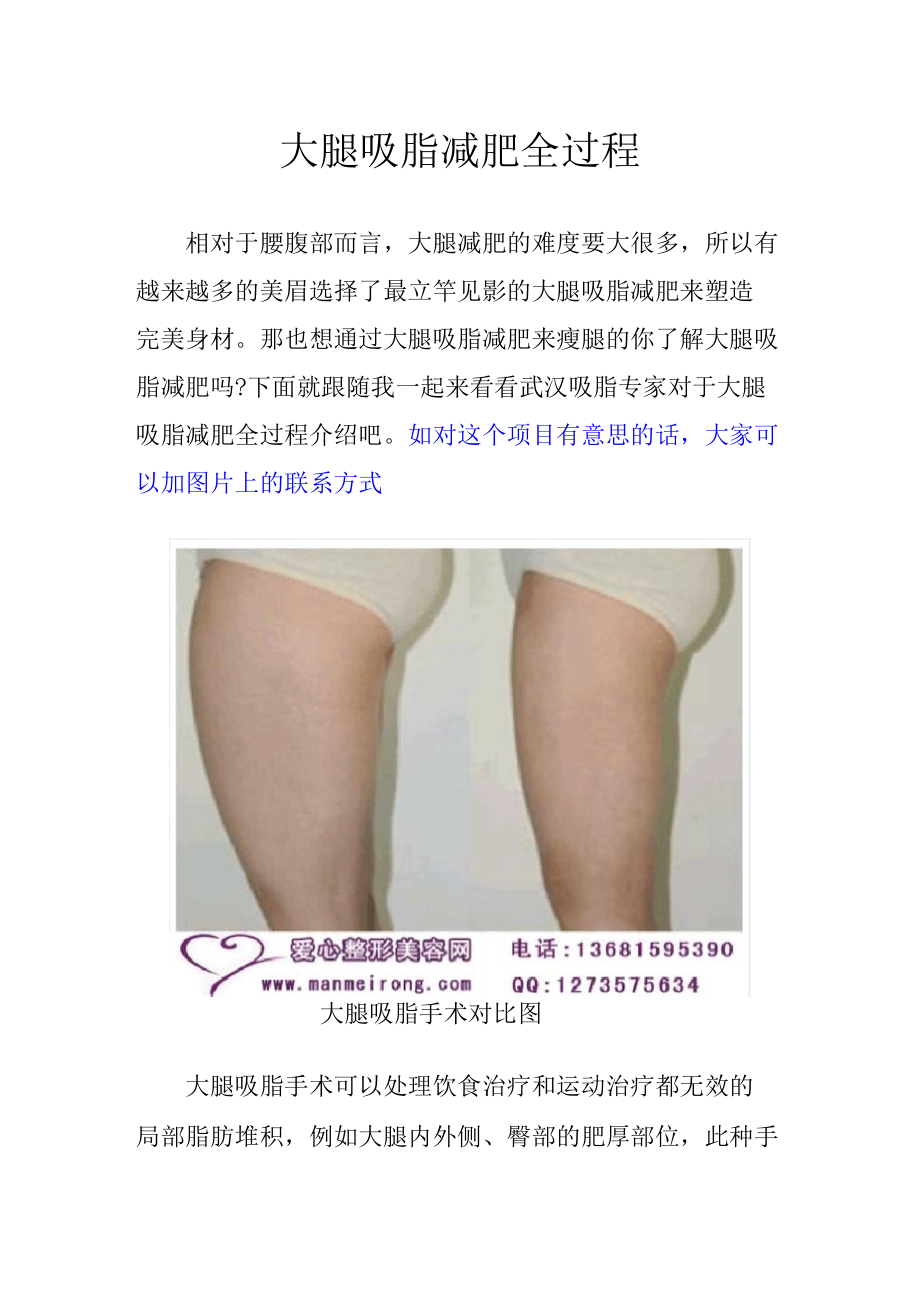 大腿吸脂减肥全过程_第1页