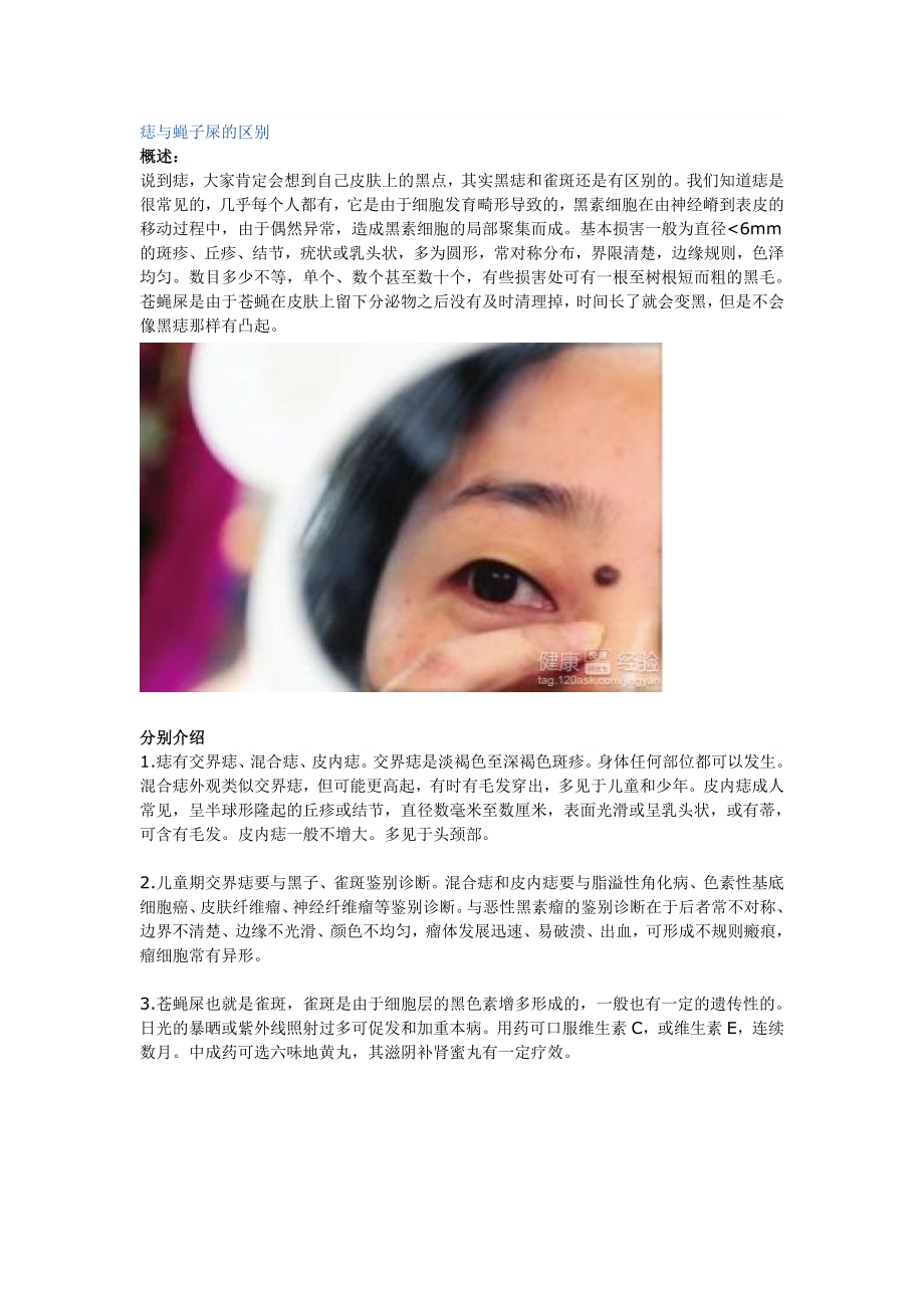 痣与蝇子屎的区别_第1页